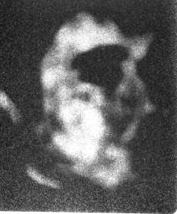 Radiesthésia de Benoit H.